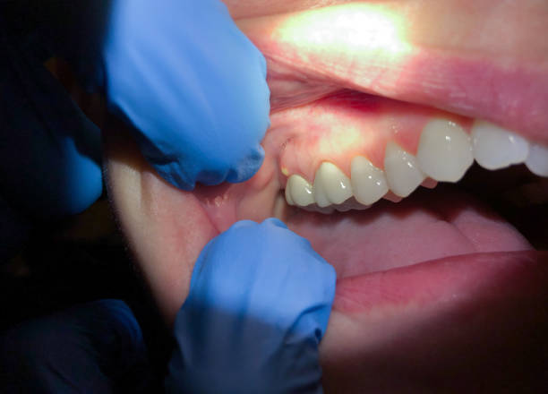 Best Knocked-Out Tooth Emergency  in Mono Vista, CA