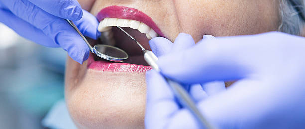 Best Chipped Tooth Repair Near Me  in Mono Vista, CA